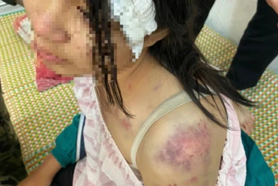 Bạo hành dã man cháu nội 12 tuổi, trách nhiệm pháp lý của bà nội ra sao?