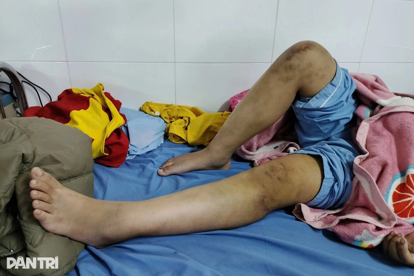 bao hanh da man chau noi 12 tuoi trach nhiem phap ly cua ba noi ra sao 1763836863587